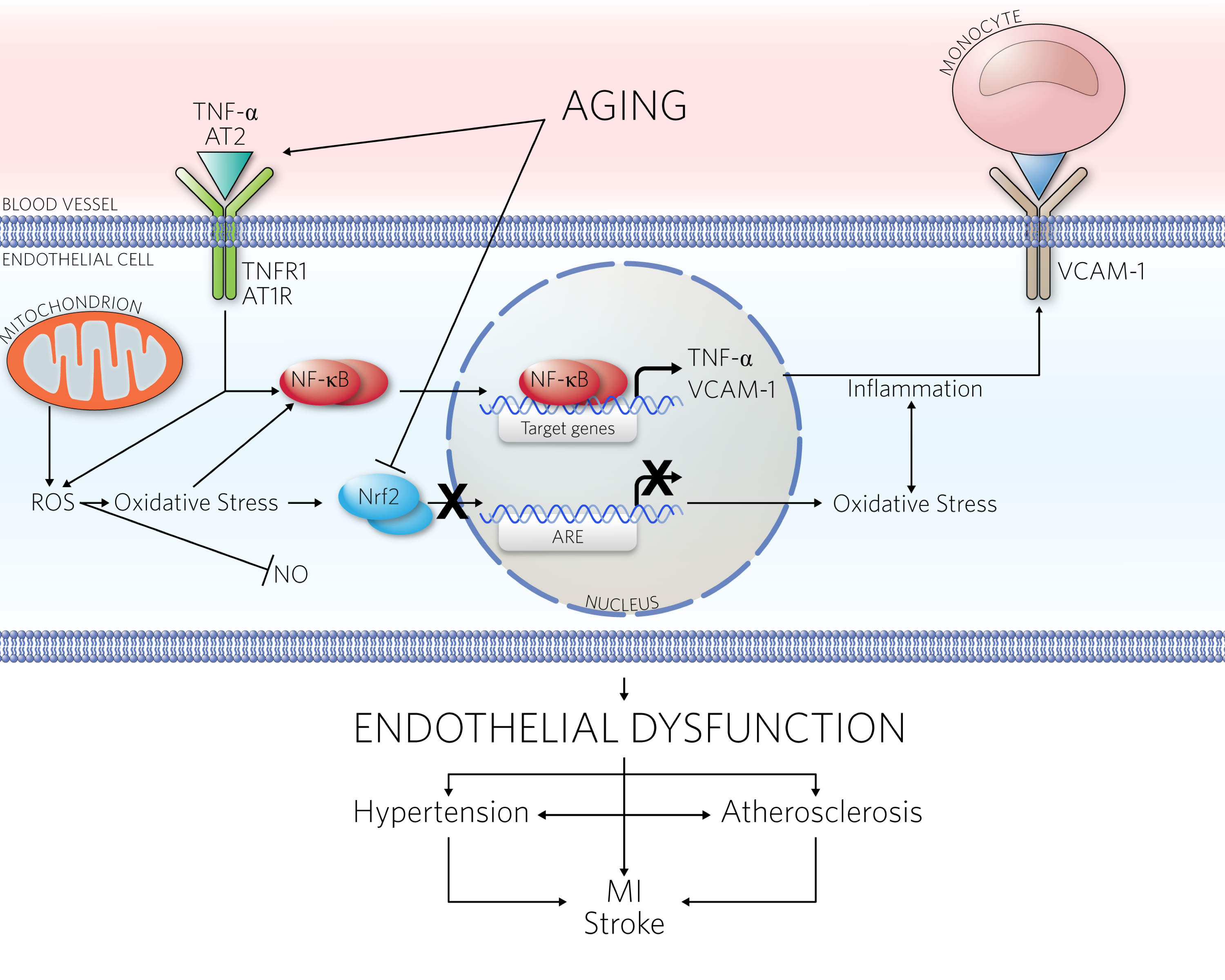 Endothelial dysfunction diagram